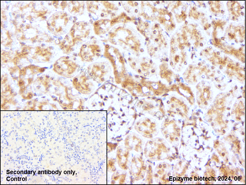 Anti-JNK1/2/3 Rabbit mAb [62M83L63]