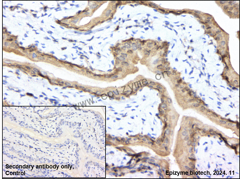 Anti-Phospho-GSK3 beta (Ser9) Rabbit mAb [79L32L94]