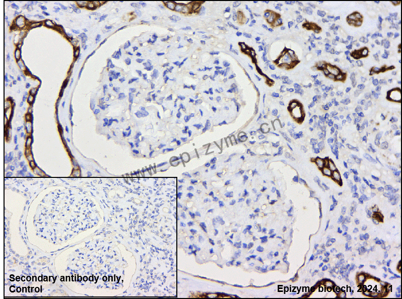 Anti-Phospho-GSK3 beta (Ser9) Rabbit mAb [79L32L94]