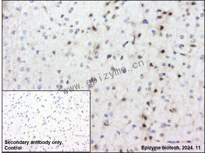 Anti-Phospho-GSK3 beta (Ser9) Rabbit mAb [79L32L94]