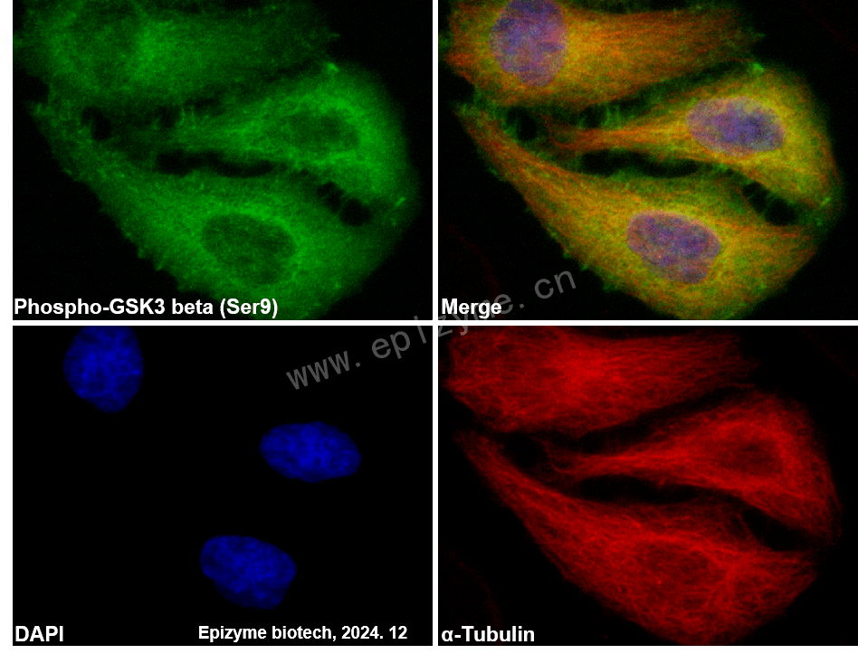 Anti-Phospho-GSK3 beta (Ser9) Rabbit mAb [79L32L94]