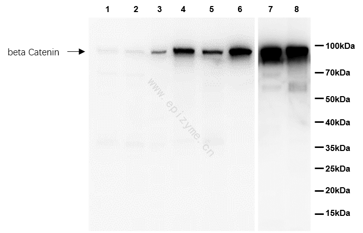 Anti-beta Catenin Rabbit mAb [41L48K19]