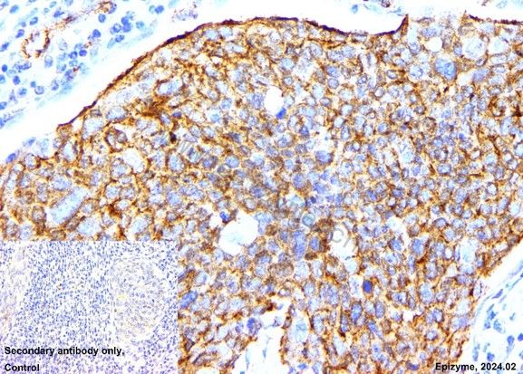 Anti-beta Catenin Rabbit mAb [41L48K19]
