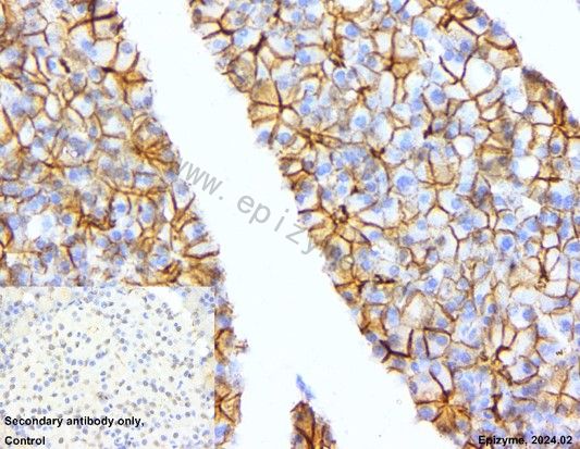 Anti-beta Catenin Rabbit mAb [41L48K19]