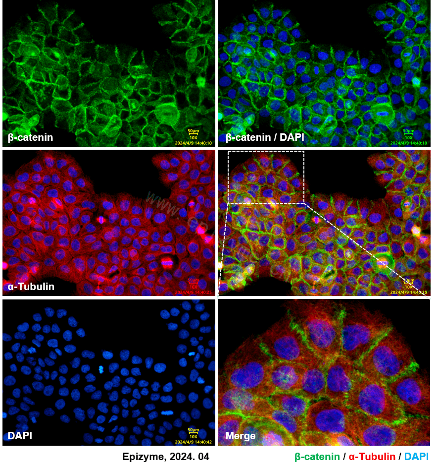 Anti-beta Catenin Rabbit mAb [41L48K19]