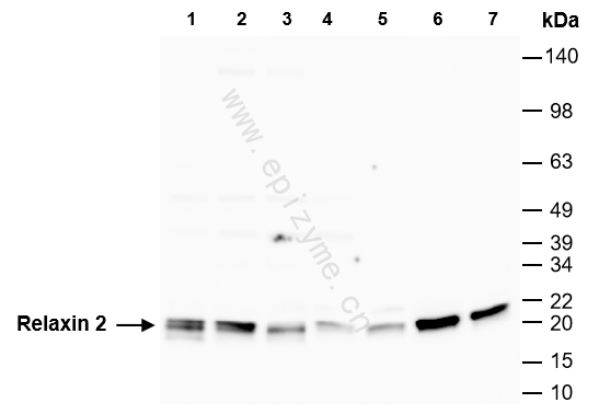 Anti-Relaxin 2 Rabbit mAb [87M47L12]