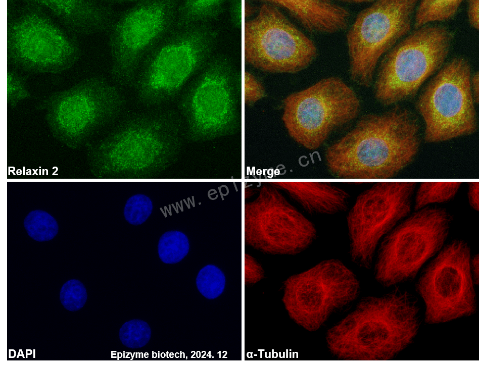 Anti-Relaxin 2 Rabbit mAb [87M47L12]