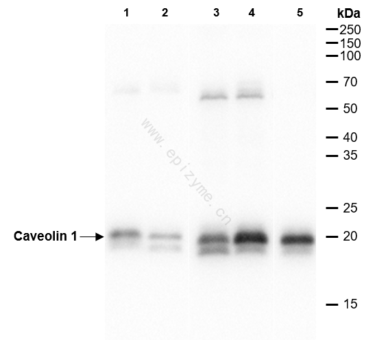 Anti-Caveolin 1 Rabbit mAb [23M64M06]