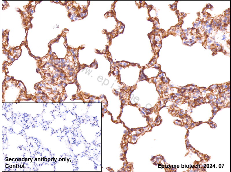 Anti-Caveolin 1 Rabbit mAb [23M64M06]