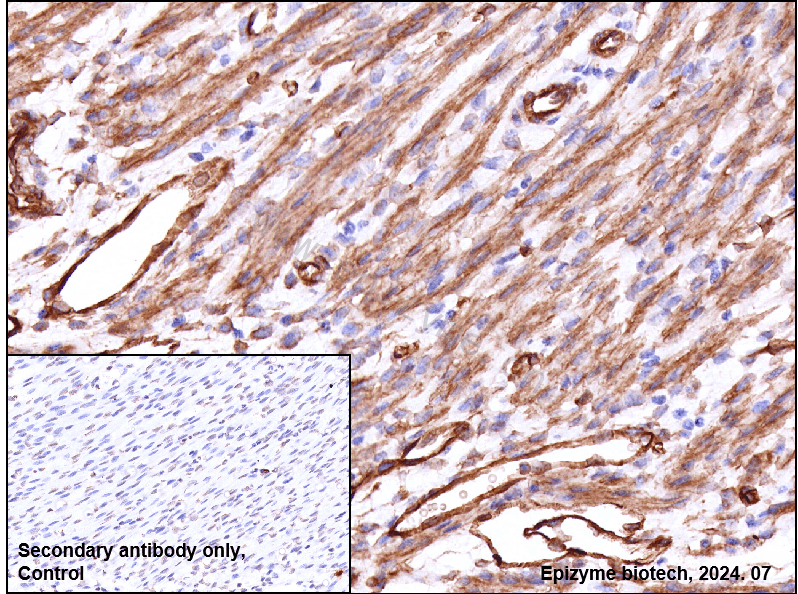 Anti-Caveolin 1 Rabbit mAb [23M64M06]