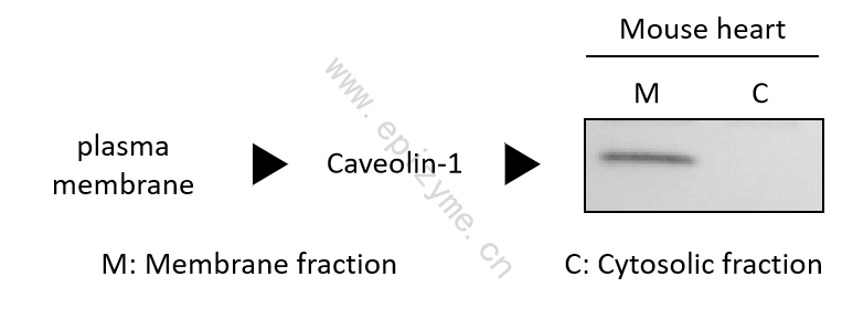 Anti-Caveolin 1 Rabbit mAb [23M64M06]