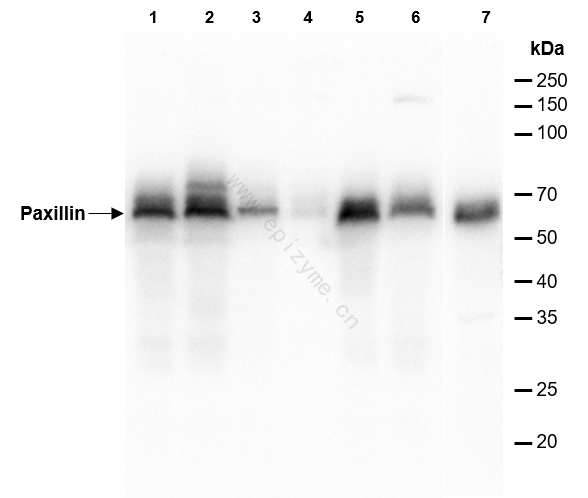Anti-Paxillin Rabbit mAb [60K75K27]