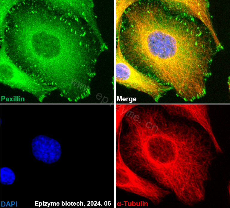 Anti-Paxillin Rabbit mAb [60K75K27]