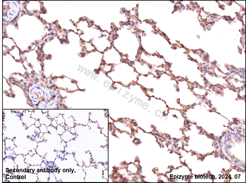 Anti-Paxillin Rabbit mAb [60K75K27]