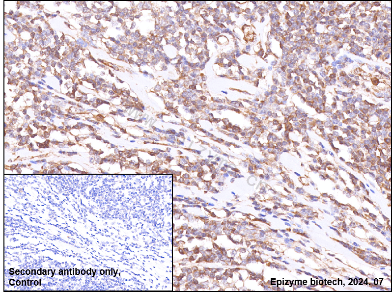 Anti-Paxillin Rabbit mAb [60K75K27]