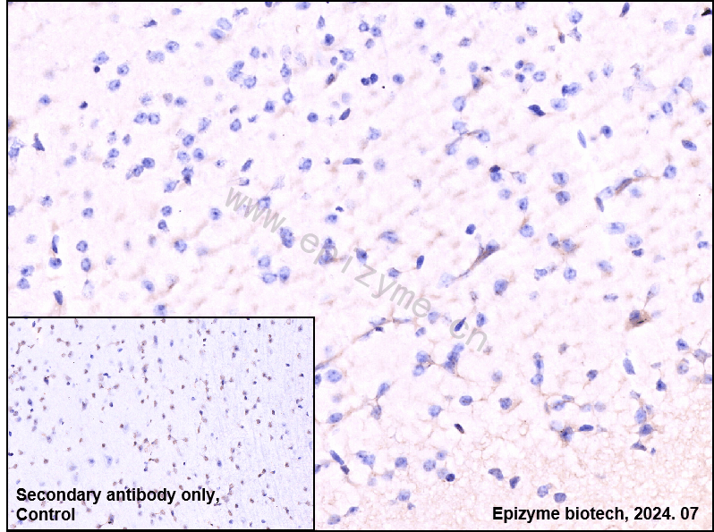 Anti-Paxillin Rabbit mAb [60K75K27]