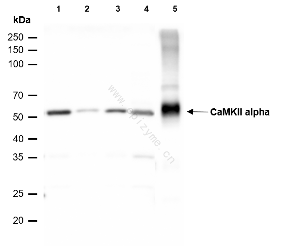 Anti-CaMK II alpha Rabbit mAb [40M09K92]