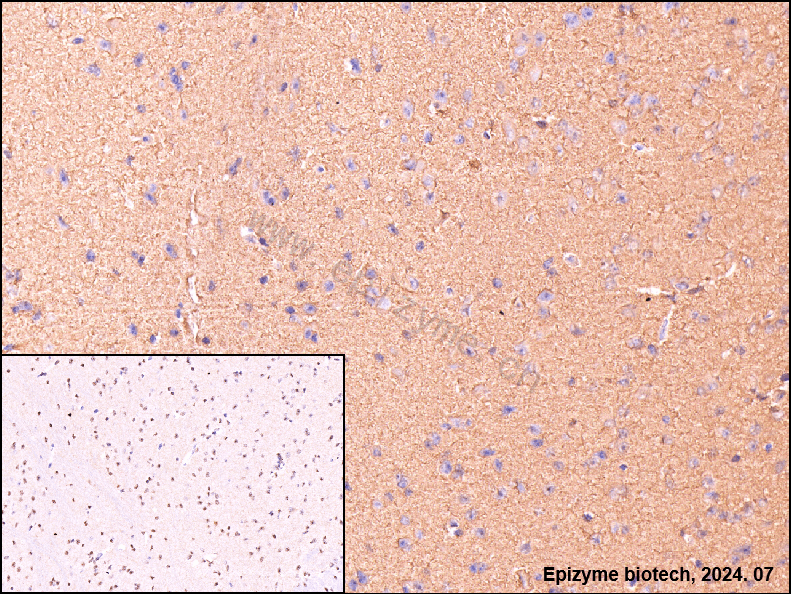 Anti-CaMK II alpha Rabbit mAb [40M09K92]