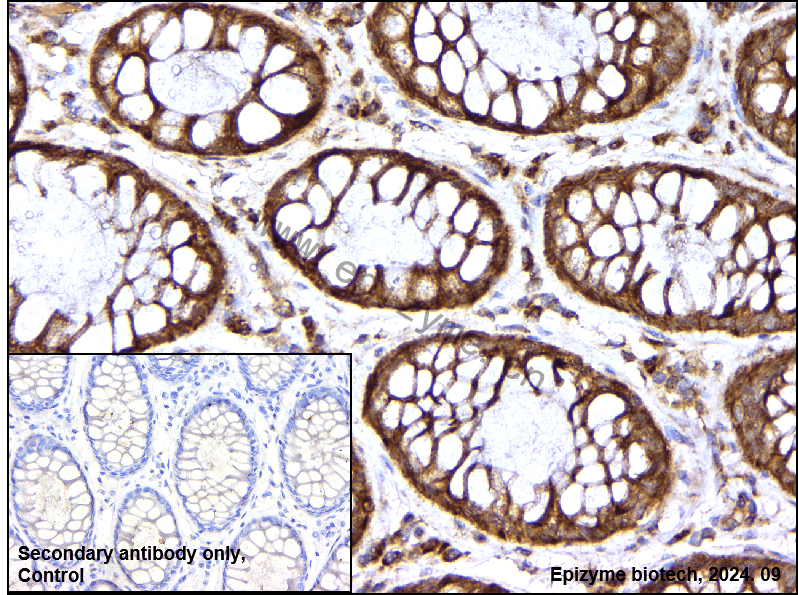 Anti-SIRT3 Rabbit mAb [62L20K67]