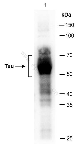 Anti-Tau Rabbit mAb [39K25M95]