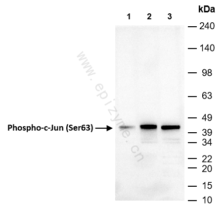 Anti-Phospho-c-Jun (Ser63) Rabbit mAb [43L31K57]