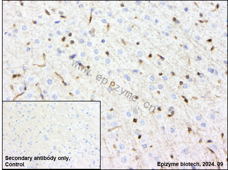 Anti-Phospho-c-Jun (Ser63) Rabbit mAb [43L31K57]