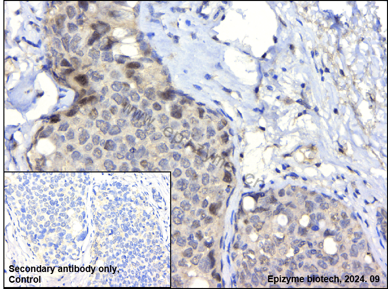Anti-Phospho-c-Jun (Ser63) Rabbit mAb [43L31K57]