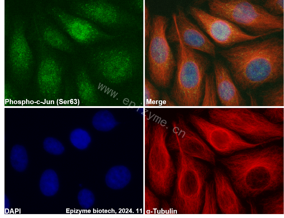 Anti-Phospho-c-Jun (Ser63) Rabbit mAb [43L31K57]