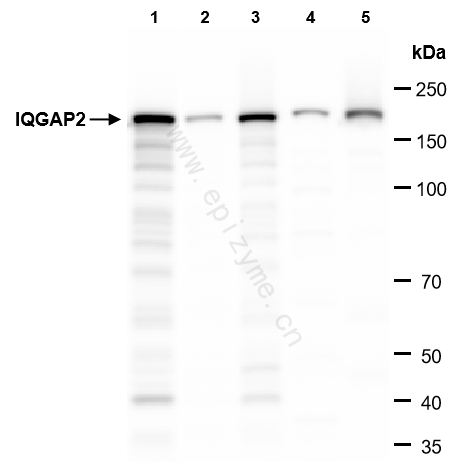 Anti-IQGAP2 Rabbit mAb [85M33M11]