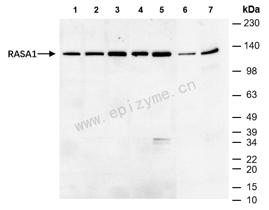 Anti-RASA1 Rabbit mAb [28M52K67]
