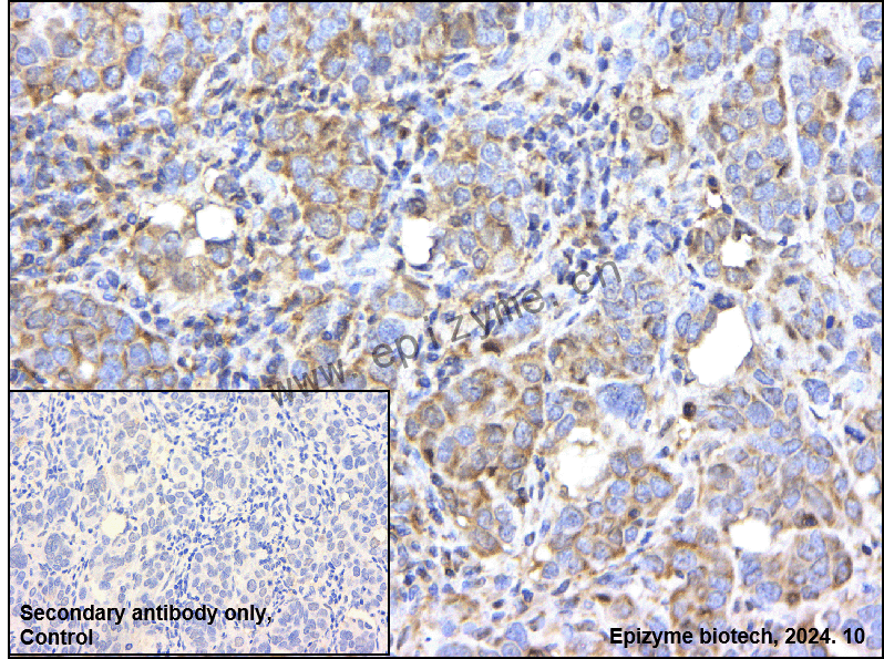 Anti-RASA1 Rabbit mAb [28M52K67]