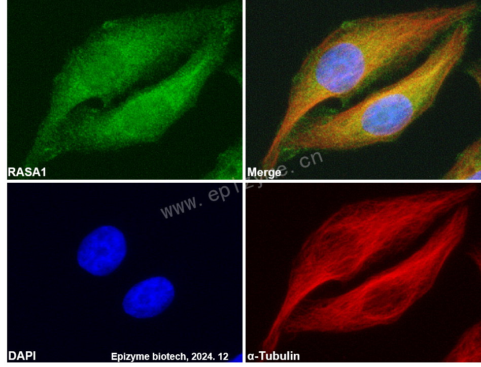 Anti-RASA1 Rabbit mAb [28M52K67]