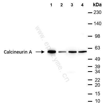Anti-Calcineurin A Rabbit mAb [95L34M48]