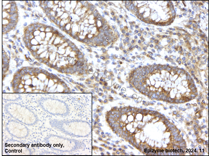 Anti-Calcineurin A Rabbit mAb [95L34M48]