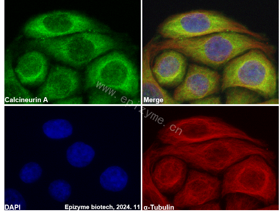 Anti-Calcineurin A Rabbit mAb [95L34M48]