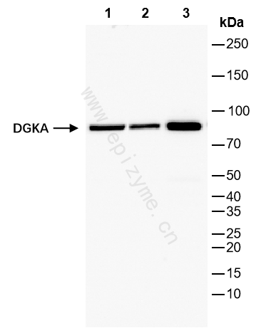 Anti-DGKA Rabbit mAb [70L85L30]