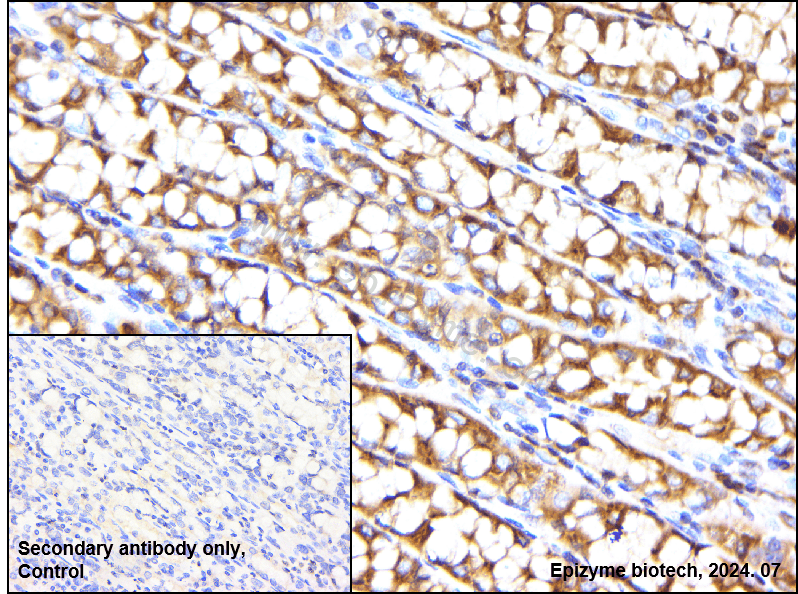 Anti-DGKA Rabbit mAb [70L85L30]