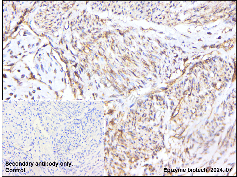 Anti-DGKA Rabbit mAb [70L85L30]