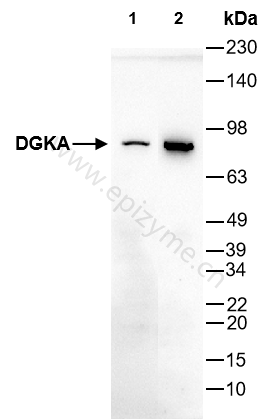 Anti-DGKA Rabbit mAb [70L85L30]