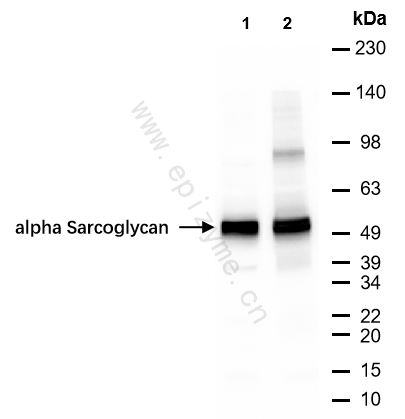 Anti-alpha Sarcoglycan Rabbit mAb [48T48D33]
