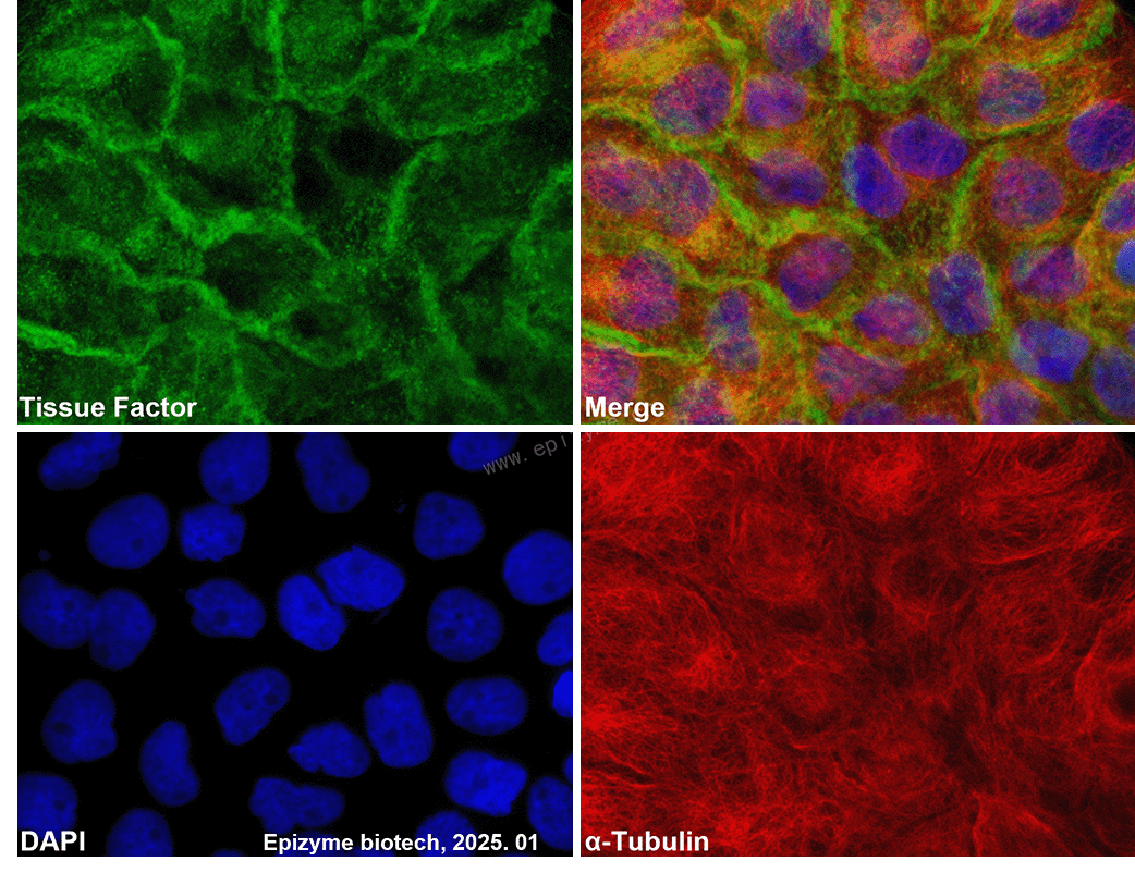 Anti-Tissue Factor Rabbit mAb [83M71K67]