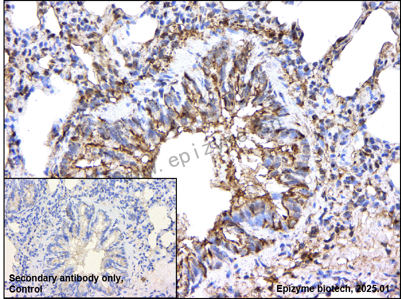 Anti-Phospho-AP2M1 (Thr156) Rabbit mAb [83M63K45]