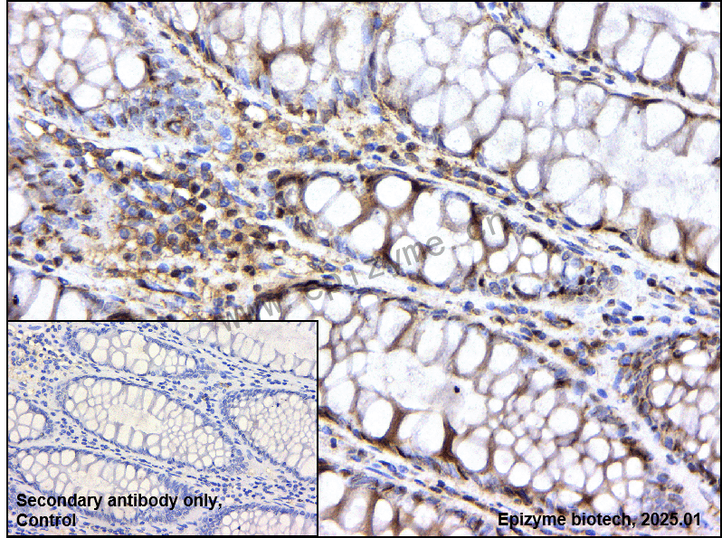 Anti-Phospho-AP2M1 (Thr156) Rabbit mAb [83M63K45]