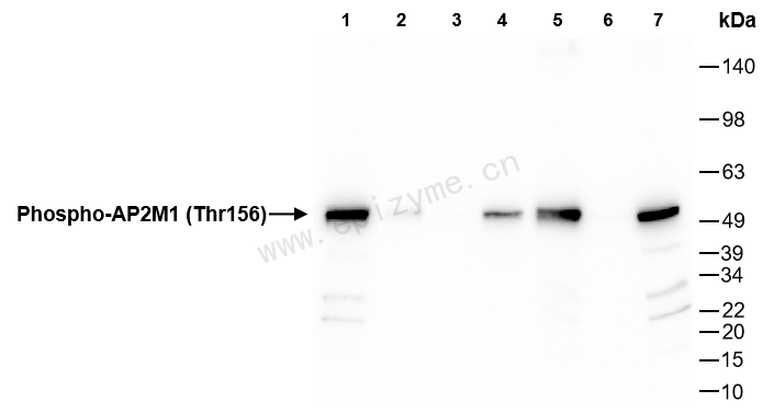 Anti-Phospho-AP2M1 (Thr156) Rabbit mAb [83M63K45]