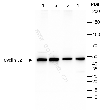 Anti-Cyclin E2 Rabbit mAb [52K21M05]