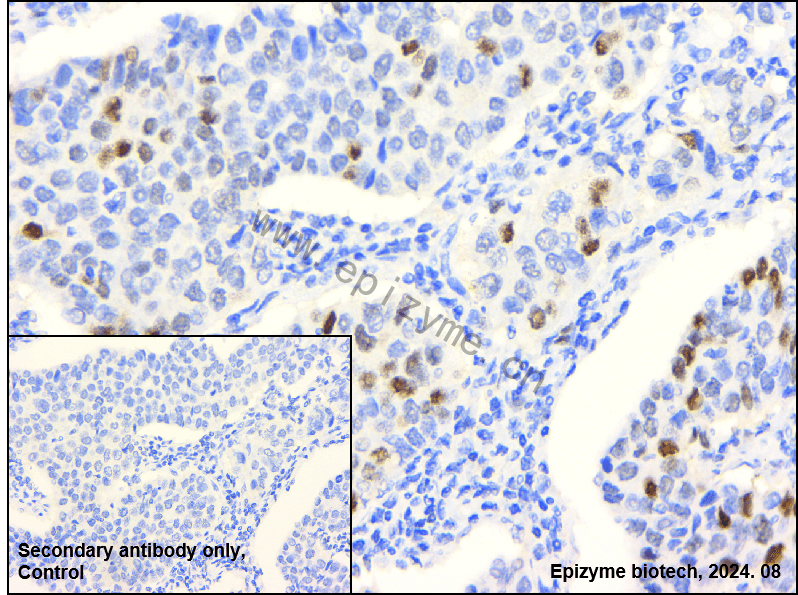 Anti-Cyclin E2 Rabbit mAb [52K21M05]