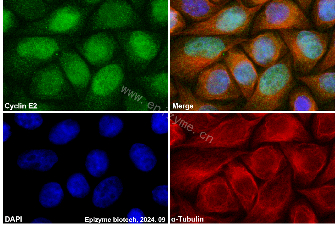 Anti-Cyclin E2 Rabbit mAb [52K21M05]