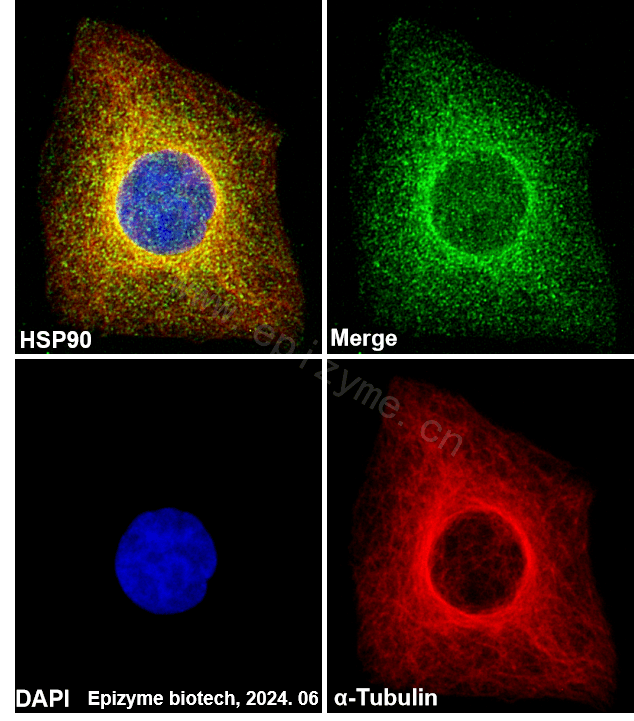 Anti-Hsp90 alpha/beta Rabbit mAb [26M41K41]