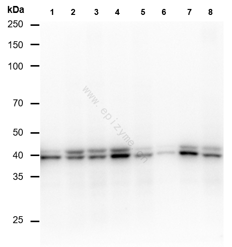 Anti-Phospho-ERK1/2 (Thr202/Thr185) Rabbit mAb [47K36K34]