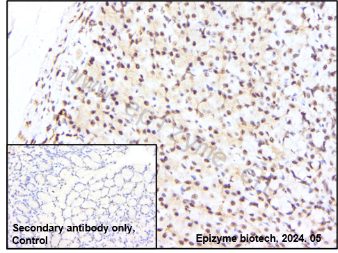 Anti-Phospho-ERK1/2 (Thr202/Thr185) Rabbit mAb [47K36K34]